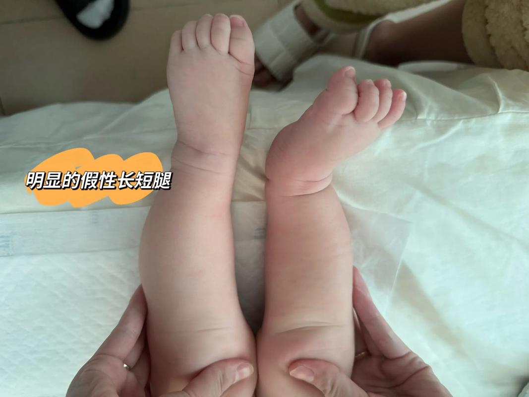 孕期检查发现宝宝腿短,真的意味着怀的是男孩吗?背后的原因到底是什么?-第1张图片-郑州医学网 孕期检查发现宝宝腿短,真的意味着怀的是男孩吗?背后的原因到底是什么?-第1张图片-郑州医学网