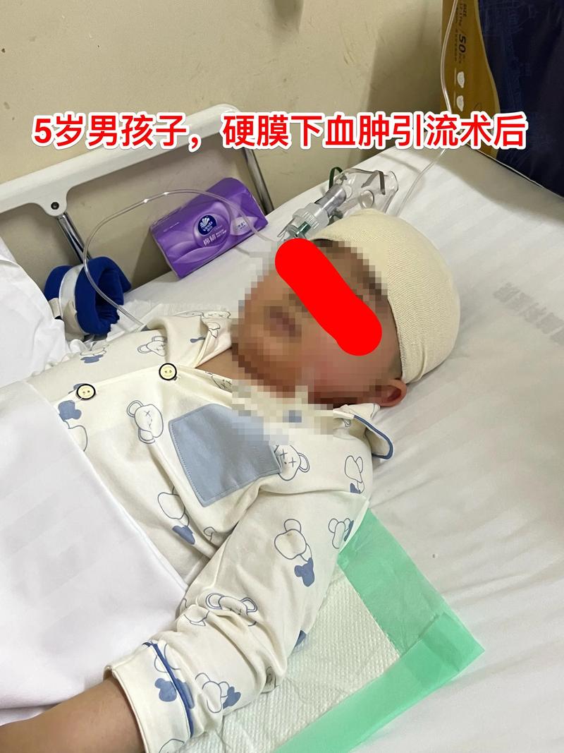 新生儿硬肿症能否自愈？不治疗会有哪些风险？-第3张图片-郑州医学网