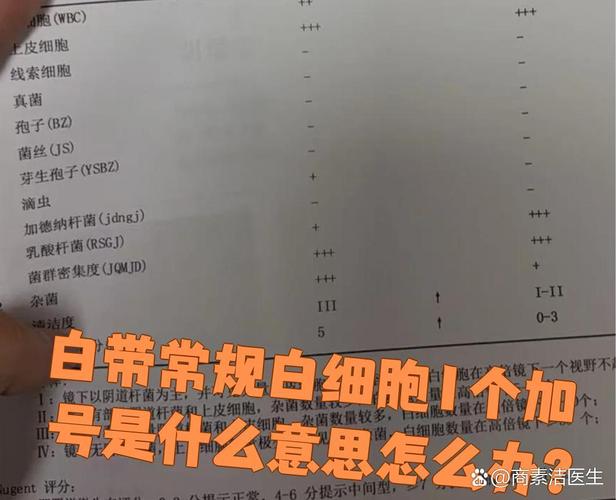孕期白带检查白细胞2+代表什么意思？会对胎儿和顺产有影响吗？-第1张图片-郑州医学网