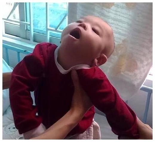 新生儿头往后仰一定是脑瘫吗？这种姿势还有哪些可能原因？-第2张图片-郑州医学网