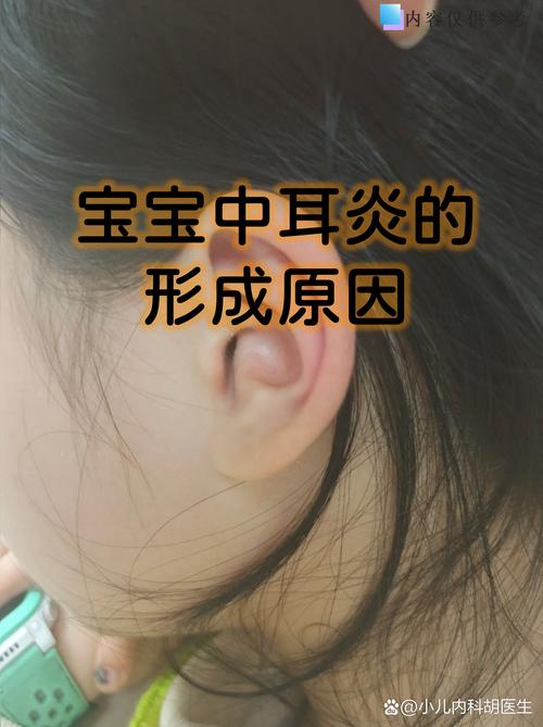 儿童中耳炎的常见症状有哪些？家长该如何早期识别与应对？-第1张图片-郑州医学网