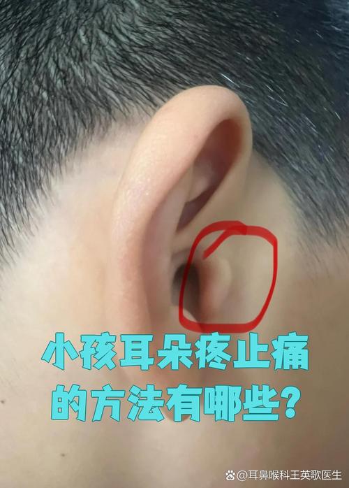 儿童中耳炎的常见症状有哪些？家长该如何早期识别与应对？-第2张图片-郑州医学网