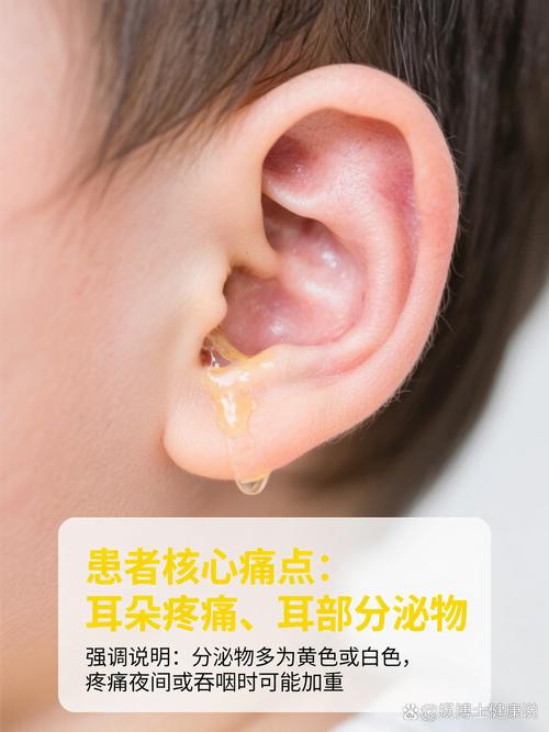 儿童中耳炎的常见症状有哪些？家长该如何早期识别与应对？-第3张图片-郑州医学网