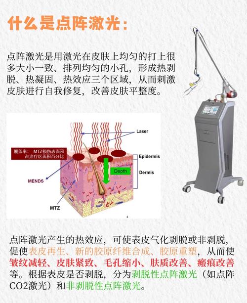 备孕期能否做点阵激光？对胎儿有潜在风险吗？-第1张图片-郑州医学网