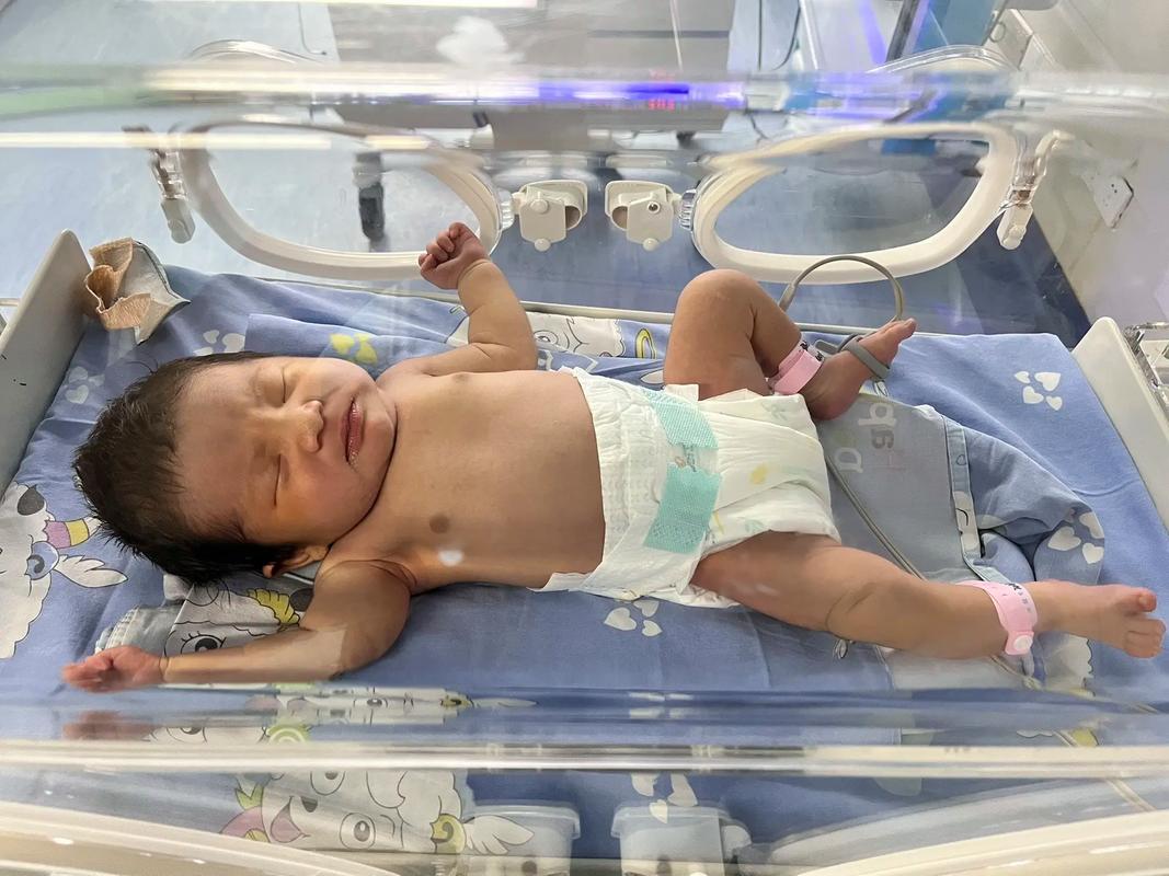 新生儿第三天出现黄疸，是正常生理现象还是需要警惕的异常信号？-第1张图片-郑州医学网