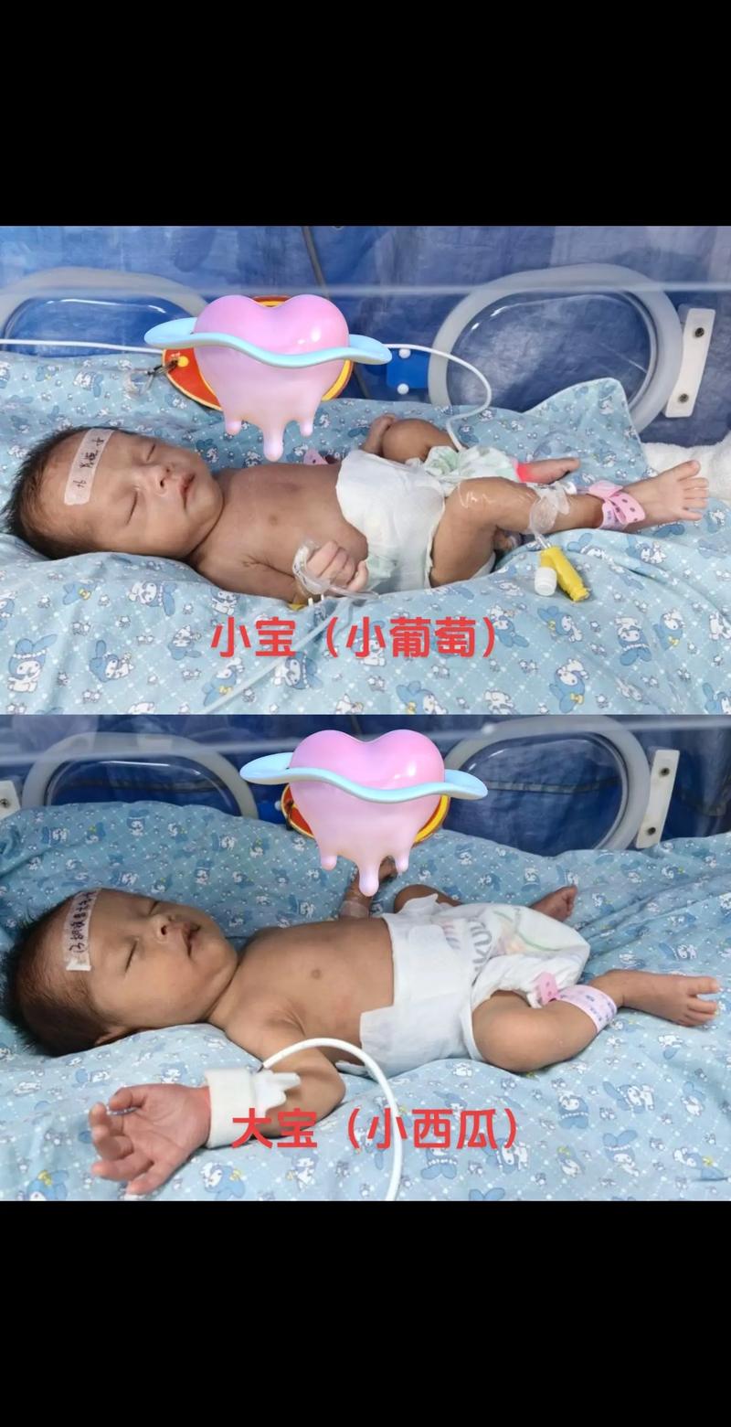 新生儿放保温箱的费用可以报销吗?医保能覆盖多少比例?-第3张图片-郑州医学网 新生儿放保温箱的费用可以报销吗?医保能覆盖多少比例?-第3张图片-郑州医学网