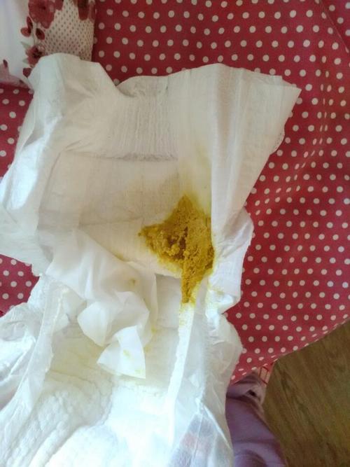 新生儿一吃完母乳就拉-第2张图片-郑州医学网