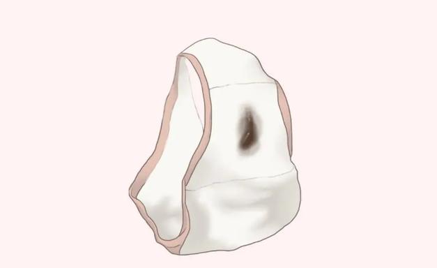 新生儿吐褐色的分泌物-第1张图片-郑州医学网