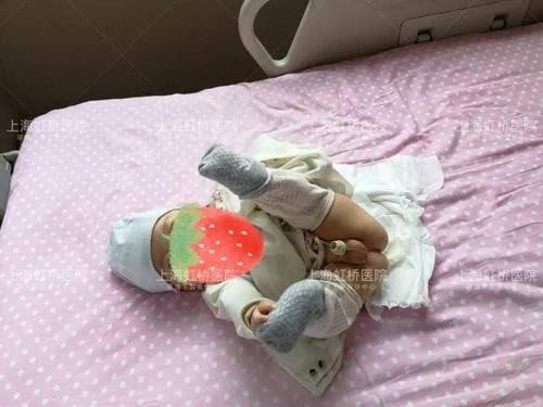 女新生儿尿道出现分泌物，是正常现象还是疾病信号？该如何正确处理？-第1张图片-郑州医学网