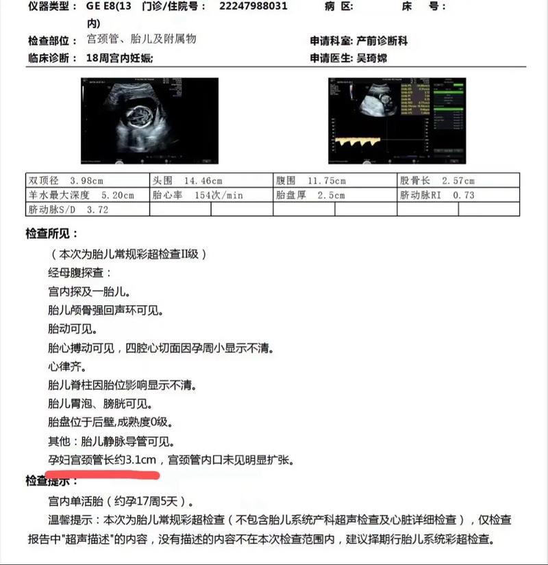 孕期怎么让宫颈管变长-第1张图片-郑州医学网