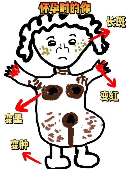孕期皮肤变差是女孩吗-第1张图片-郑州医学网