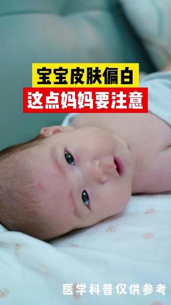 新生儿为什么手部肤色比面部更白皙？是生理现象还是健康信号？-第3张图片-郑州医学网