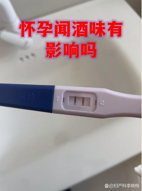 孕期如何精准排查胎儿脑神经发育异常？检查方法有哪些？-第3张图片-郑州医学网