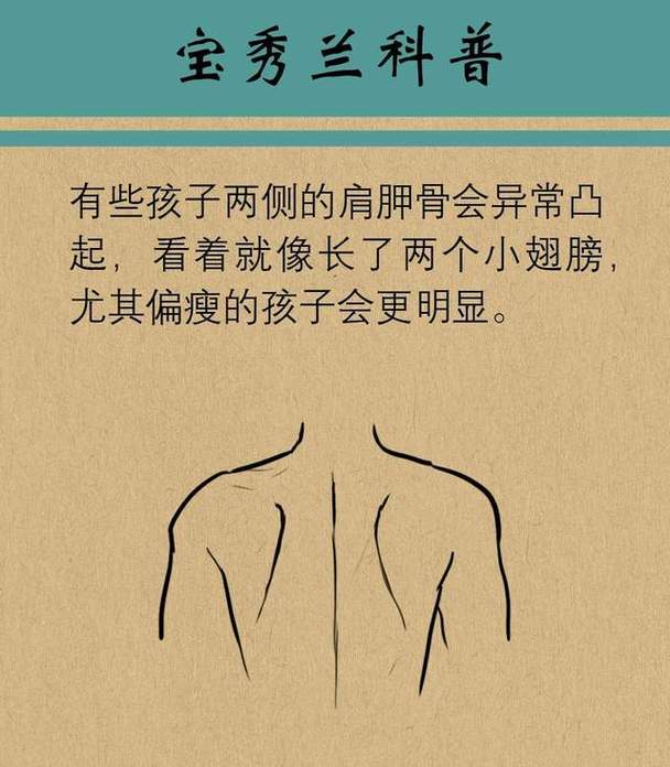 儿童肩胛骨突出是正常现象还是疾病信号？家长该如何科学干预？-第2张图片-郑州医学网