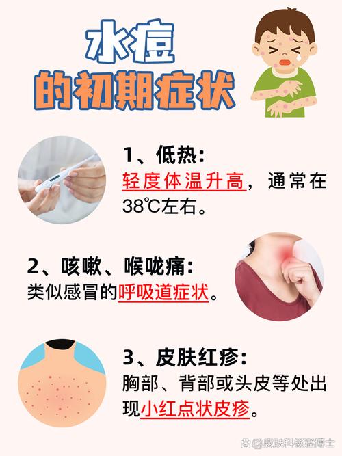 孩子出水痘发烧了，物理降温能不能用？需要吃退烧药吗？-第1张图片-郑州医学网