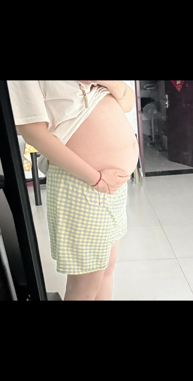 孕期体重涨了肚子却不大，是胎儿发育异常还是脂肪分布异常？-第3张图片-郑州医学网