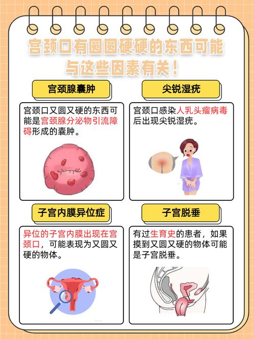 孕期宫颈息肉怎么检查？需要做哪些特殊检查，对胎儿有影响吗？-第3张图片-郑州医学网