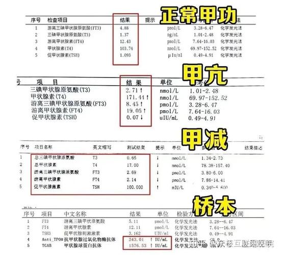 孕期甲状腺功能到底该查几项？关键指标有哪些？对母婴健康有何影响？-第1张图片-郑州医学网
