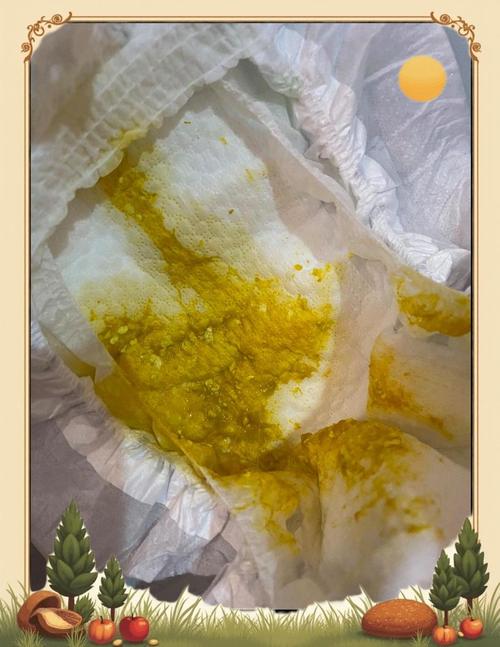 新生儿大便全是奶瓣是消化不良还是正常现象？-第1张图片-郑州医学网