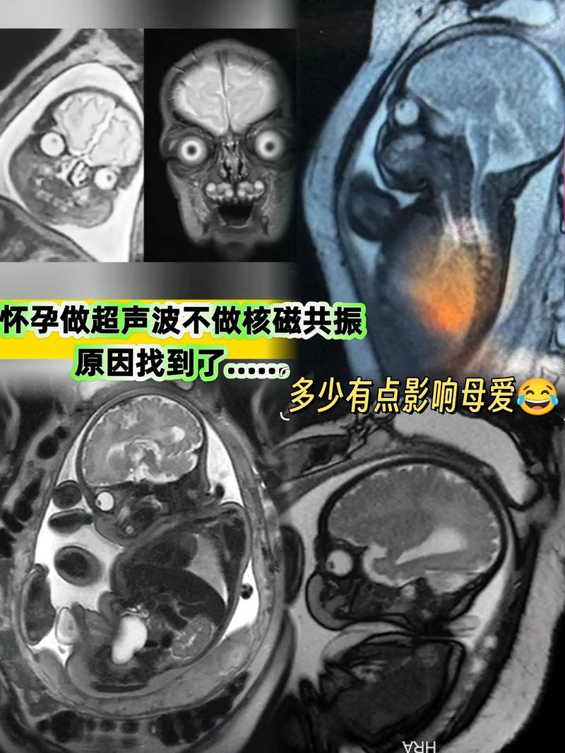 新生儿做磁共振检查费用是多少？不同地区和医院收费标准差异大吗？-第1张图片-郑州医学网