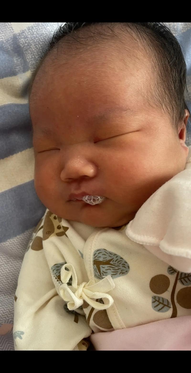 新生儿10天流黄鼻涕是正常现象还是感染信号？需警惕哪些潜在问题？-第2张图片-郑州医学网