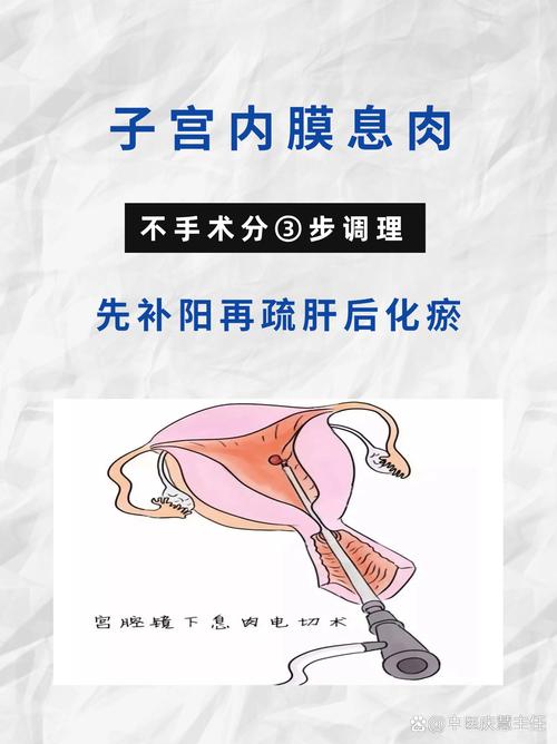 孕期宫颈息肉出血危险吗？如何快速有效止血又不影响胎儿？-第1张图片-郑州医学网