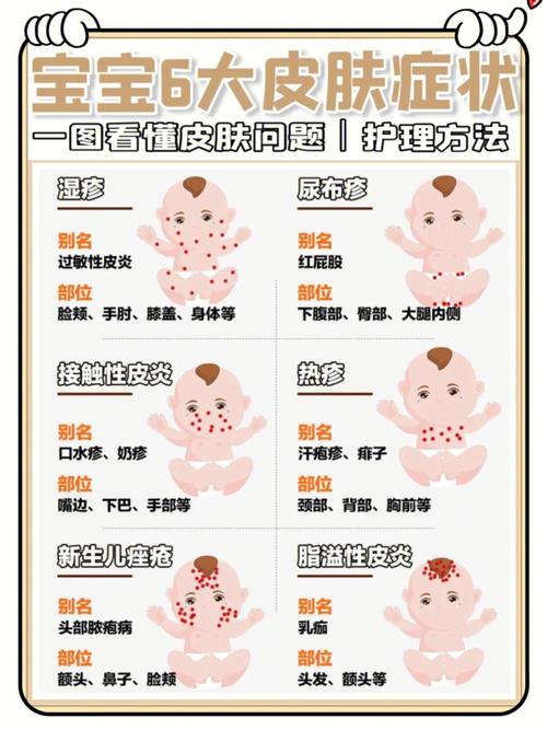 新生儿肤色变化图解，从粉红到黝黑，究竟藏着哪些健康信号？-第2张图片-郑州医学网