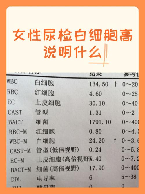 孕期尿检白细胞170严重吗？需要治疗吗？对胎儿有影响吗？-第3张图片-郑州医学网