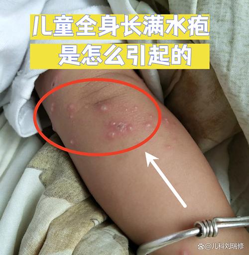 新生儿水土不服会出现哪些症状？家长该如何辨别和应对？-第1张图片-郑州医学网