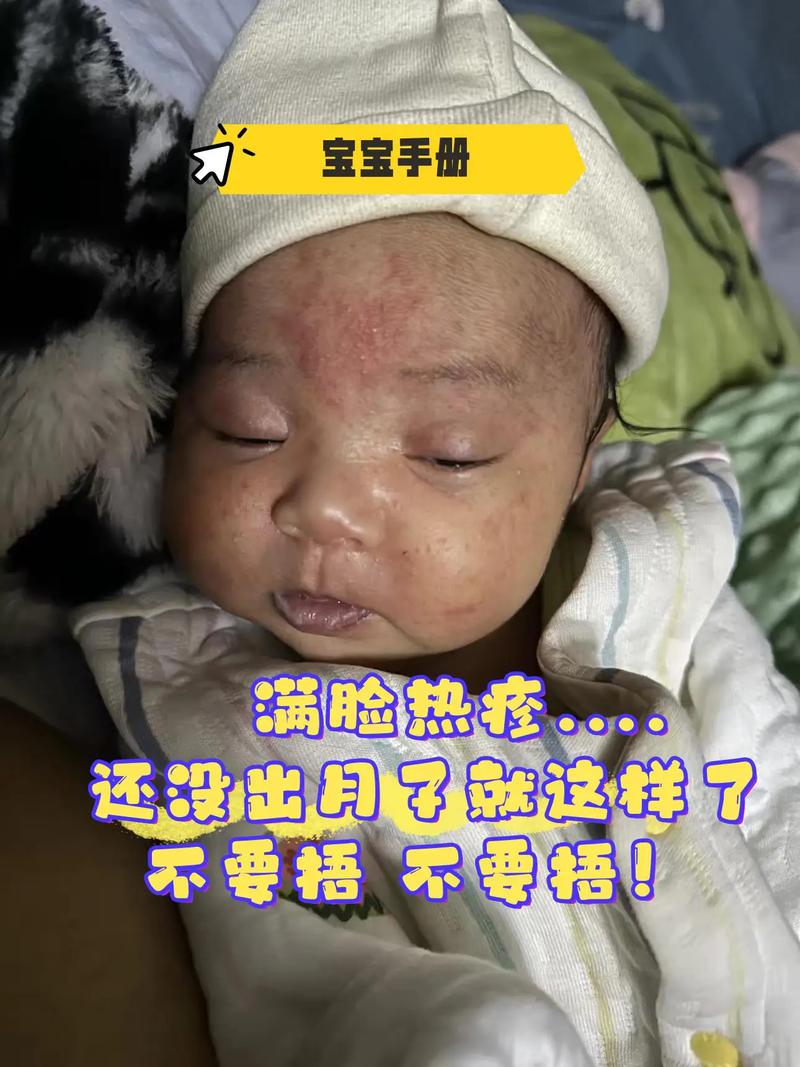 新生儿水土不服会出现哪些症状？家长该如何辨别和应对？-第3张图片-郑州医学网