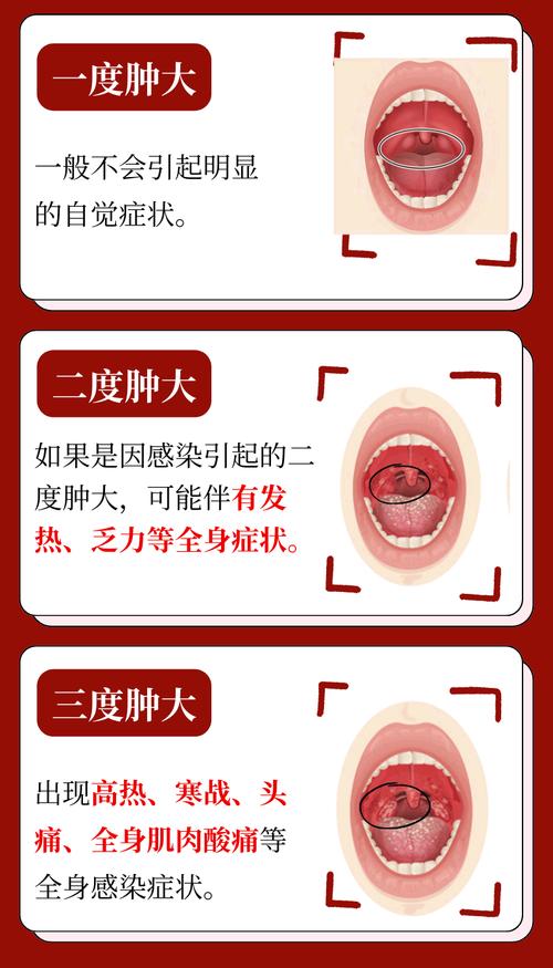 儿童扁桃体切除后免疫力会下降吗？有哪些潜在危害需家长警惕？-第2张图片-郑州医学网