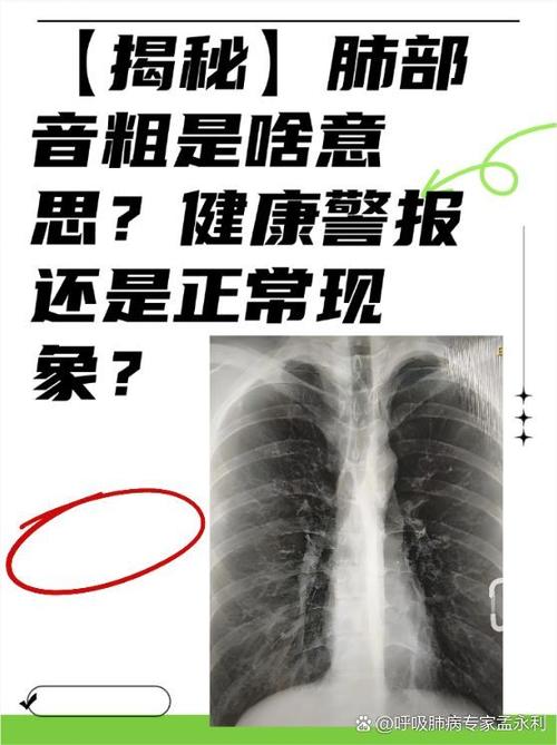 新生儿肺部罗音严重吗？需警惕哪些潜在风险与应对措施？-第1张图片-郑州医学网