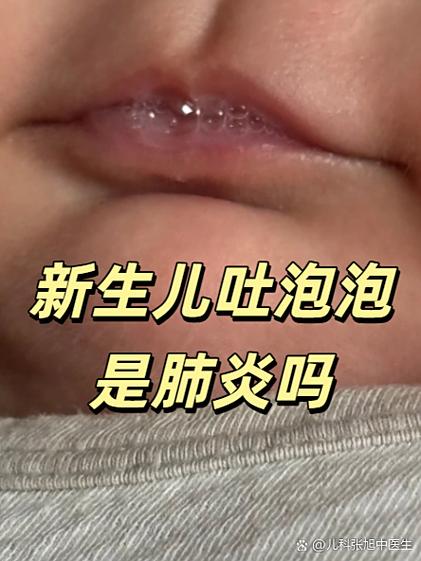 儿童肺炎初期症状有哪些容易被忽略的表现？家长该如何识别？-第2张图片-郑州医学网