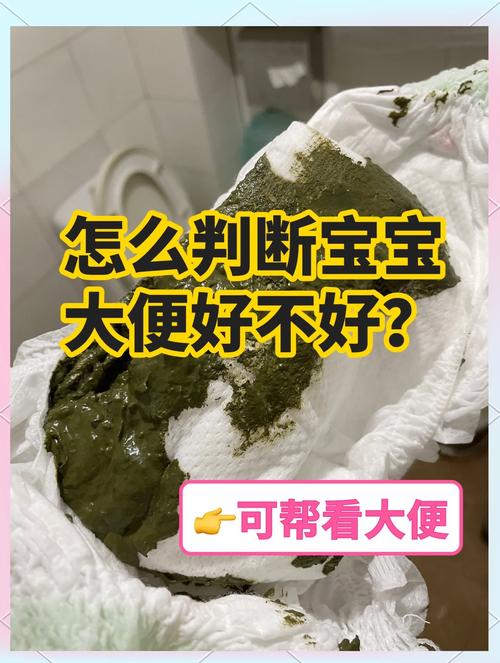 新生儿拉干粑粑是正常现象还是消化异常信号？-第3张图片-郑州医学网
