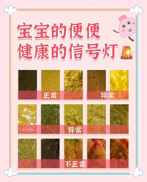 新生儿拉干粑粑是正常现象还是消化异常信号？-第2张图片-郑州医学网