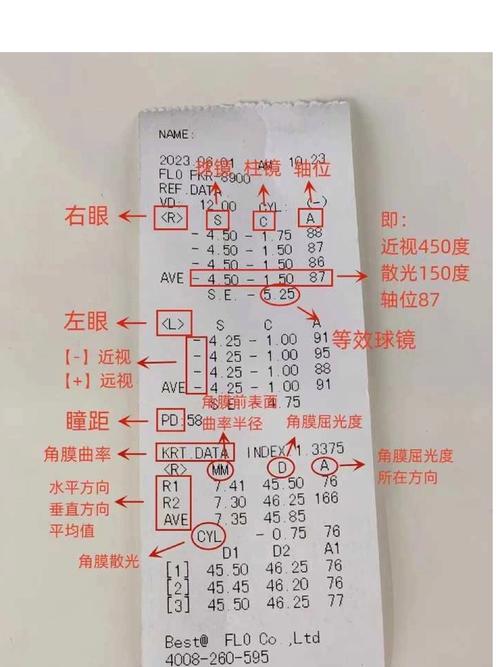 新生儿眼睛筛查具体怎么做？有哪些关键步骤和注意事项？-第1张图片-郑州医学网