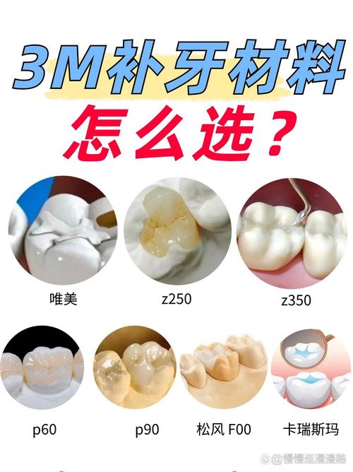 儿童补牙材料怎么选？哪种安全又耐用，家长纠结时该听谁的？-第1张图片-郑州医学网