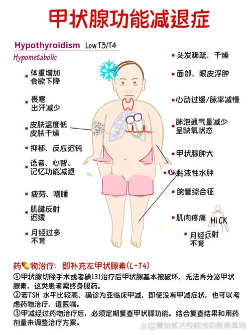 新生儿亚临床甲减对远期神经发育有哪些潜在危害？-第2张图片-郑州医学网