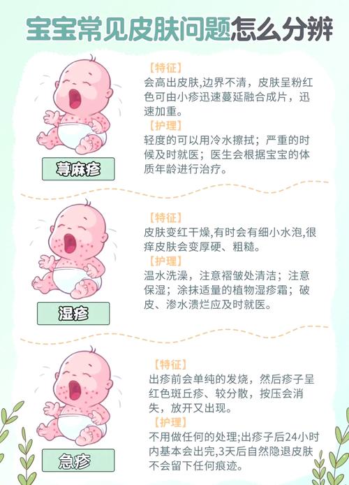 新生儿金葡菌感染究竟源于哪些常见途径？母婴传播、环境接触还是护理疏漏？-第1张图片-郑州医学网