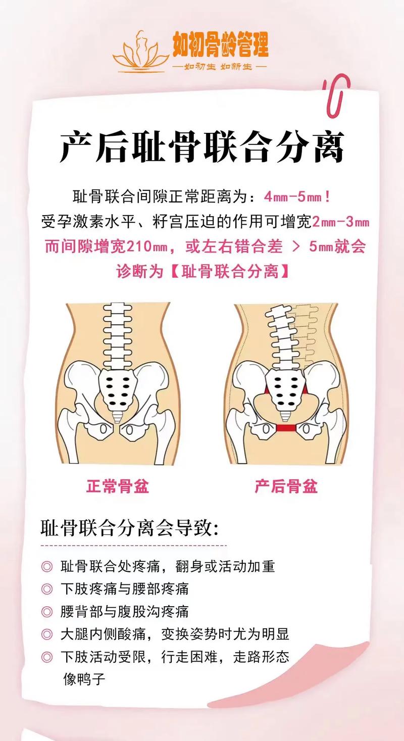 孕期耻骨分离怎么检查？需要做哪些检查项目？-第1张图片-郑州医学网