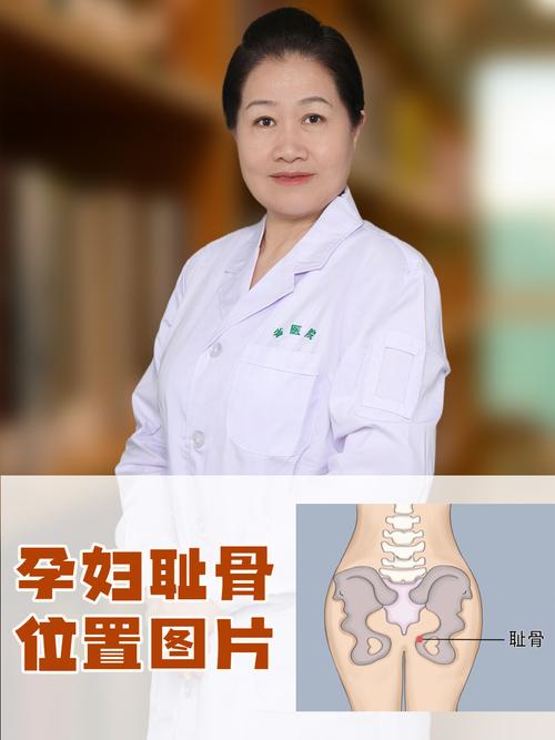 孕期耻骨分离怎么检查？需要做哪些检查项目？-第2张图片-郑州医学网