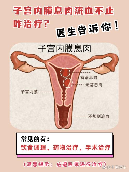 孕期宫颈息肉持续出血，会对胎儿造成不良影响吗？该如何有效处理？-第3张图片-郑州医学网