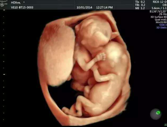 孕期抽烟真的会导致畸形宝宝吗？这些图片背后的真相与警示是什么？-第1张图片-郑州医学网