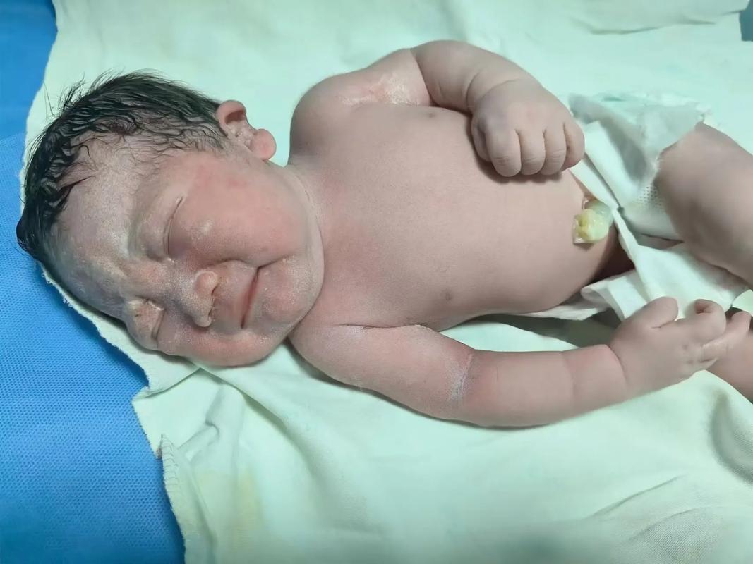 孕期抽烟真的会导致畸形宝宝吗？这些图片背后的真相与警示是什么？-第3张图片-郑州医学网