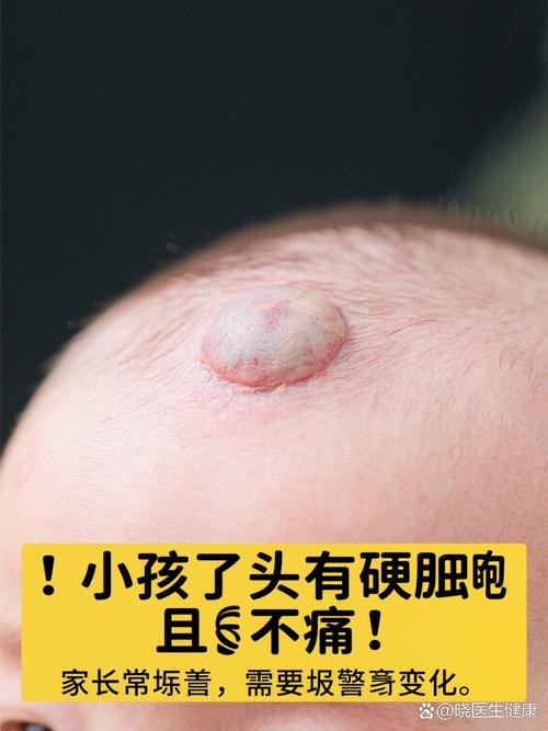 儿童纤维性骨皮质缺损到底是什么病？家长必须了解的成因、症状与治疗全攻略-第3张图片-郑州医学网