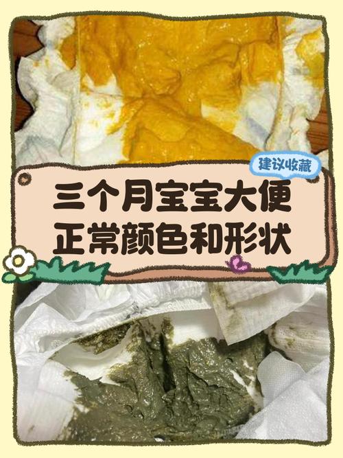 新生儿大便拉水是正常的生理现象还是疾病信号？家长该如何判断与应对？-第1张图片-郑州医学网
