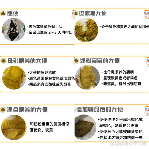 新生儿大便拉水是正常的生理现象还是疾病信号？家长该如何判断与应对？-第2张图片-郑州医学网