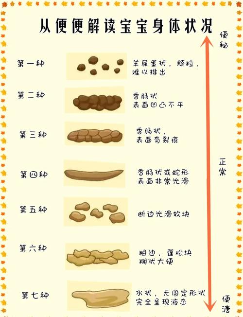 新生儿大便拉水是正常的生理现象还是疾病信号？家长该如何判断与应对？-第3张图片-郑州医学网