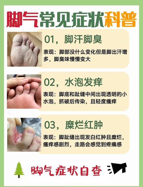 儿童脚气反复发作，到底哪种方法才能彻底根治且不复发？-第1张图片-郑州医学网