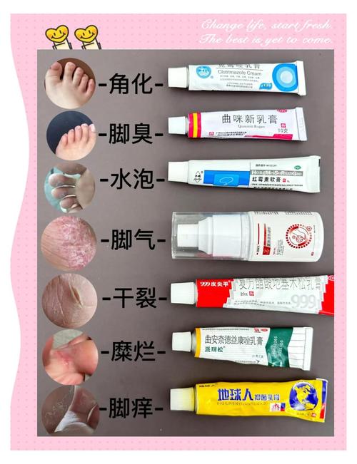 儿童脚气反复发作，到底哪种方法才能彻底根治且不复发？-第2张图片-郑州医学网